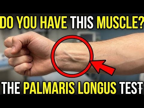 Only 1% Have This! Rare Genetic Mutations & Body Signs Revealed