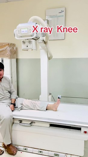 X Ray Knee Radiology Views Explained