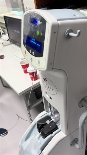 Angiojet: Innovación en Trombectomía Farmacomecánica