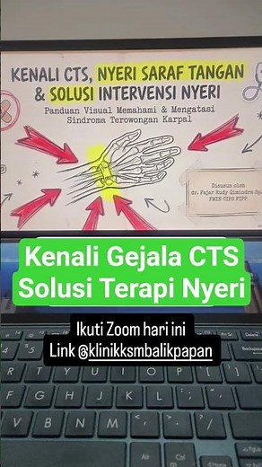 Kenali Gejala CTS dan Solusi Terapi Nyeri, Ikuti Zoom Gratis ya #edukasi