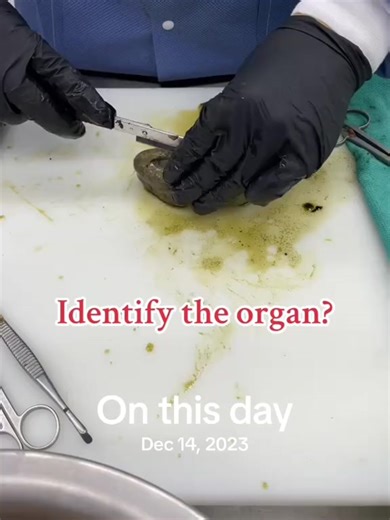 Surgical Pathology Insights for December 14, 2023