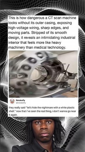 What a CT Scanner Really Looks Like Without Its Casing