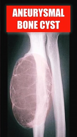 Why Is This Bone So Swollen? ABC on X-Ray 🦴