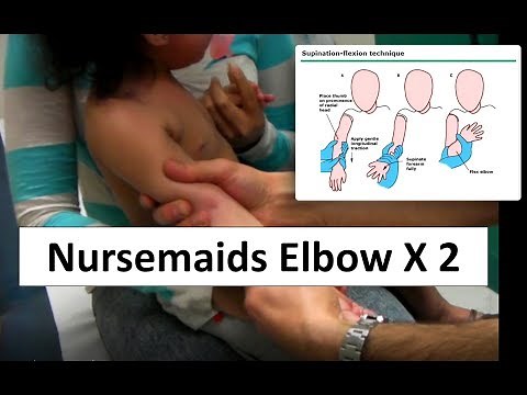 Nursemaids Elbow Reduction Times Two