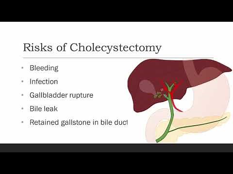 What is Laparoscopic Cholecystectomy?