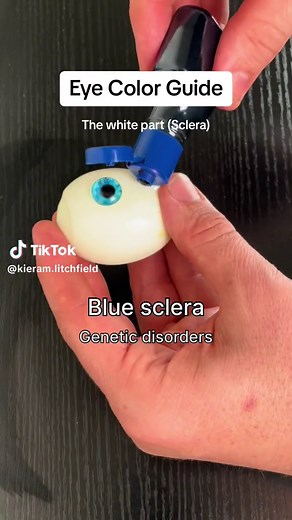 Discover Your Eye Color with the Sclera Color Chart