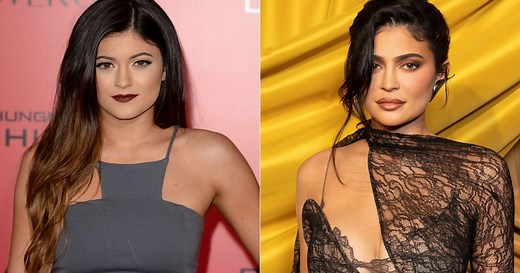 Adults Who Got Plastic Surgery As Teens Reveal Their Regrets About It