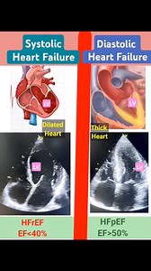 715K views · 2.9K reactions | Systolic and Diastolic Heart failure | Med G | Facebook