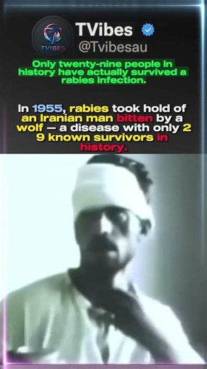 1955 Footage Shows a Man Dying of Rabies — Only 29 People Have Ever Survived It.