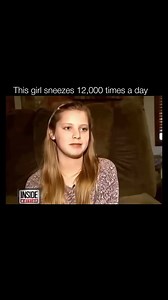 😤 Sneezing is a reflex action that occurs when the nasal passages are irritated, triggering an involuntary expulsion of air from the nose and mouth. This reflex is the body’s way of clearing irritants like dust, pollen, pet dander, or pathogens such as viruses and bacteria from the nasal cavity. When an irritant is detected, the brain signals the muscles in the chest, diaphragm, and throat to contract, forcing a rapid burst of air out at speeds up to 100 miles per hour. This explosive release c