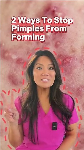 2 Ways To Stop Pimples From Forming
