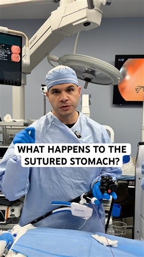 What happens to the part of the stomach that’s sutured during ESG?