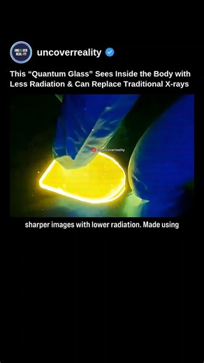This Quantum Glass Sees Inside The Body With Less Radiation & Replace X-rays #tech #shorts #quantum