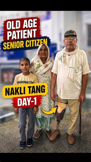 🦿☺️Artificial leg For Senior citizens | Waterproof Prosthetic Leg #ampute #ossur #ottobock #best