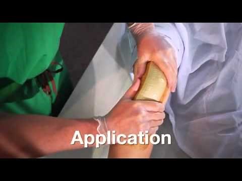 AQUACEL Surgical - Application video