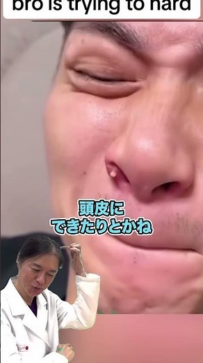 [Acne on the Nose] Painful acne near the nostrils! If it gets worse and worsens, see a doctor imm...