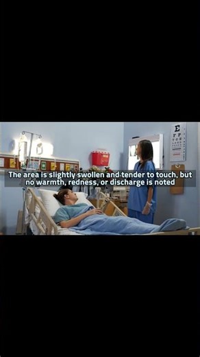 Hematoma After Bone Marrow Biopsy 🚨Key Nursing Assessments (Size, Color, Tenderness, Redness, Fever)