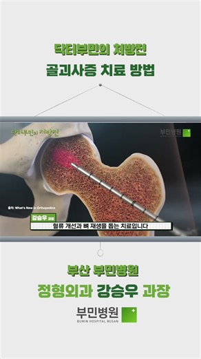 골괴사증 치료 방법 #부산부민 #닥터부민 #골괴사증