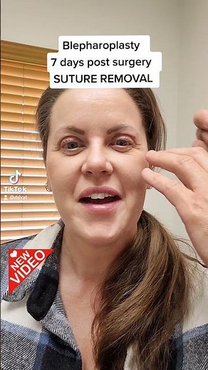 Blepharoplasty Suture Removal