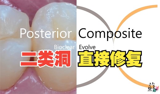 后牙二类洞的树脂直接修复解析：Posterior Composite with Bioclear Evolve (lecture)