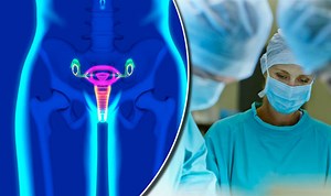 Vaginal mesh warning: What YOU should know about the vagina surgery