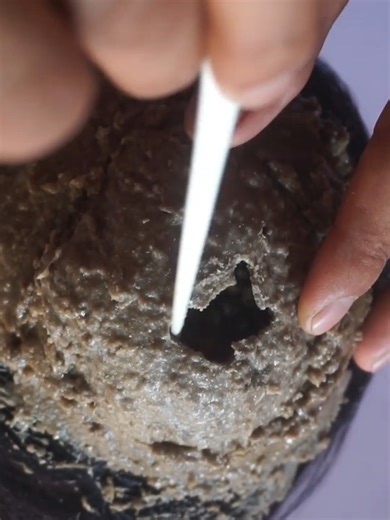 Easy dandruff treatment for cleaning #DandruffScratching #ItchyDryScalp #HugeFlakes #Dandruff #dandrufftreatment #satisfying #dandruffremoval Disclaimer: Videos do not show original Dandruff,they are used for education purpose. Thank You,,, | Hit's