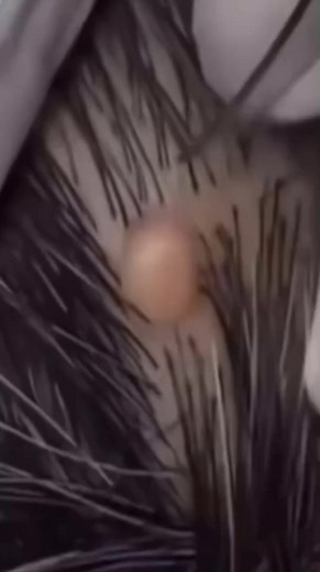 😱 You won't believe what came out of this one... #pimplepop #satisfying | Rescue Animals