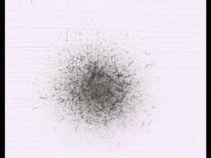 Nocardia spp with aerial hyphae