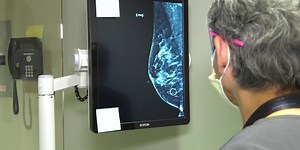Buddy Check 3: Abbreviated MRI helps women with dense breast tissue