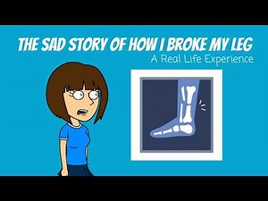 The Story Of How I Broke My Leg - A Real Life Experience