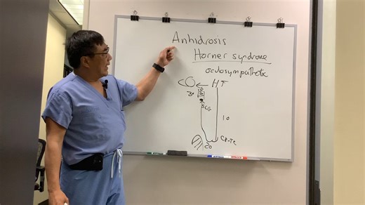 Anhidrosis in Horner Syndrome - 霍纳综合征无汗症