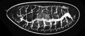 Respiratory system of insects - Alchetron, the free social encyclopedia