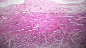 Stomach Fundic Portion Section Filmed Under Stock Footage Video (100% Royalty-free) 1106784543 | Shutterstock