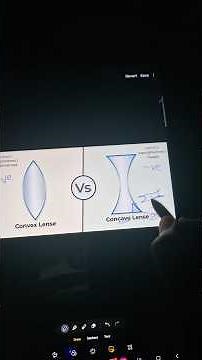 Concave vs convex lens #opthalmology
