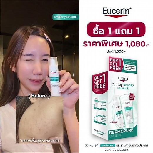 Manage all acne and acne scar problems. See results in 2 weeks with Eucerin Triple Action and Gel...