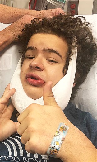 Stranger Things actor reveals surgery plans