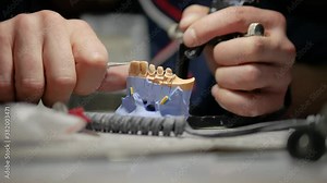 Dental technician work,tooth sharpening,denture tooth milling,dentistry clinic,ceramic tooth crown based on a plaster model.