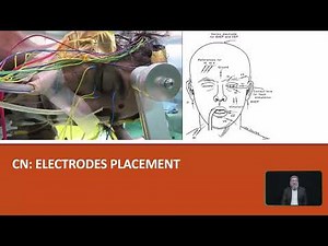 Cranial Nerve Monitoring & Mapping. Part 2