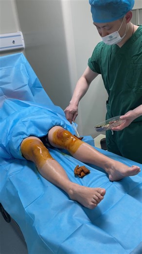 Understanding Knee Sterilization Procedures in Hospitals