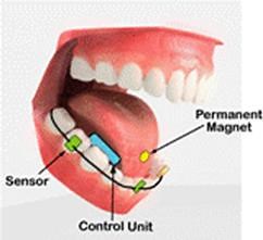 Tongue-driven wheelchair interface gives new flavor to HCI