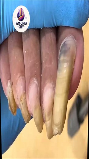 32K views · 253 reactions | Senior Foot Care: maintain discolored nails, prevent issues  #FootCareTips #HealthyHabits #SafeSteps | I am Chef Shy | Facebook