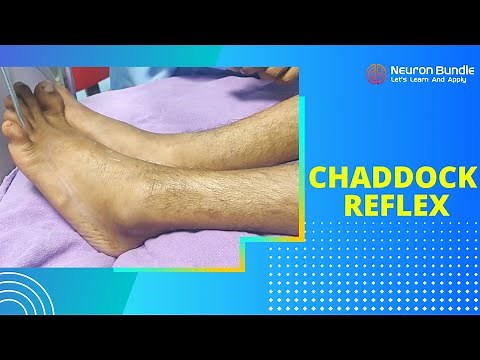 chaddock reflex | an alternative to babinski sign | corticospinal tract lesion #neurology