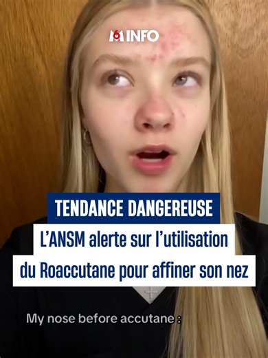 Alerte : Roaccutane utilisé à des fins esthétiques