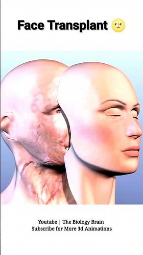 How Face Transplant Surgery Actually Works (Animation) #biology #shorts #3danimation