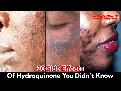 20 Side Effects Of Hydroquinone You Didn’t Know
