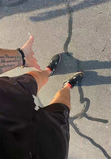 Exploring Leg Issues and Unexpected Outcomes