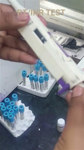 PT/INR TEST #labtechnician #paramedical #labtechnologist #medicalstudent #pathology