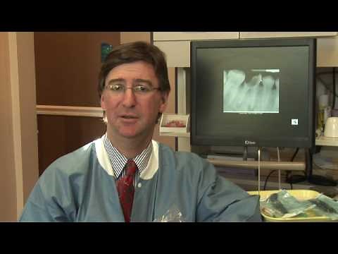 Tooth Abscess : What Antibiotics Do I Take for an Abscessed Tooth?