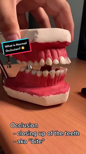 Understanding Normal Occlusion in Orthodontics
