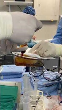 Hip Augmentation with Implants | Transgender Female Body Surgery